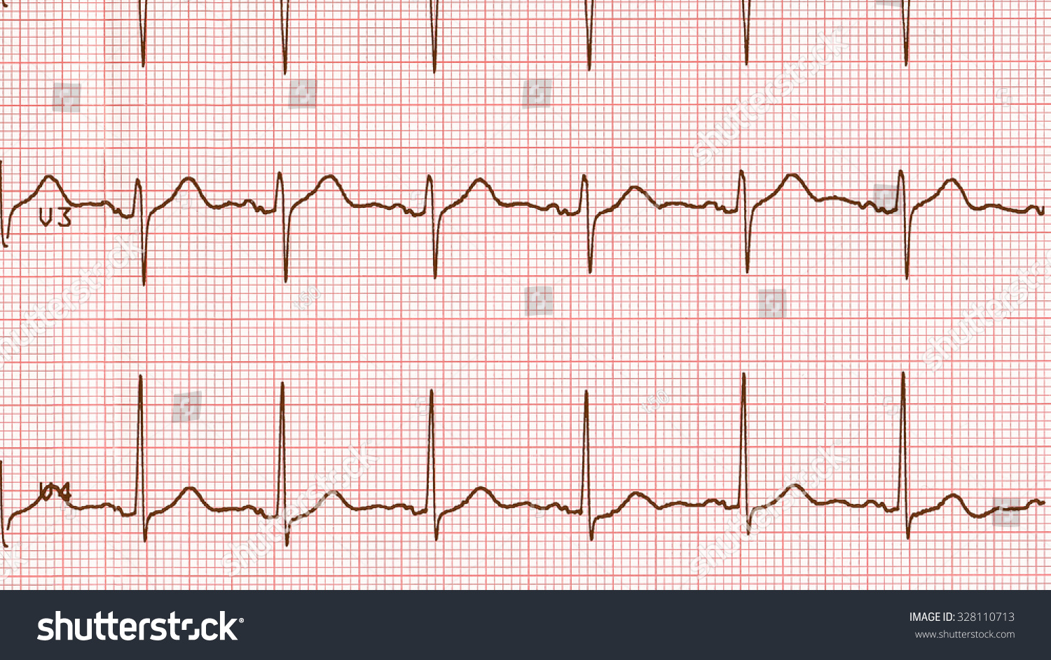 Vintage Looking Electrocardiography Aka Ekg Elektrokardiogramm Stock ...