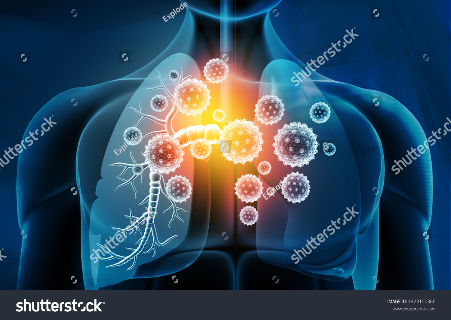 399,200 Respiratory infections Images, Stock Photos & Vectors ...