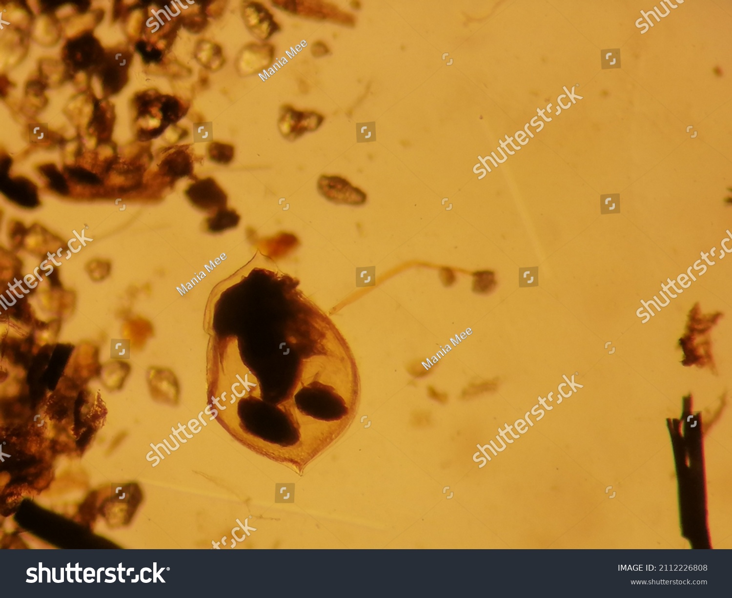 Water Flea Group Zooplankton Under Microscope Stock Photo (edit Now 