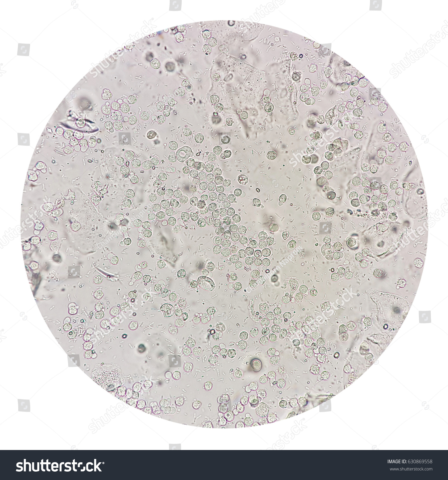 White Blood Cells Bacteria Urine Under Stock Photo Edit Now 630869558 White Blood Cells Bacteria Urine Under Stock Photo Edit Now 630869558