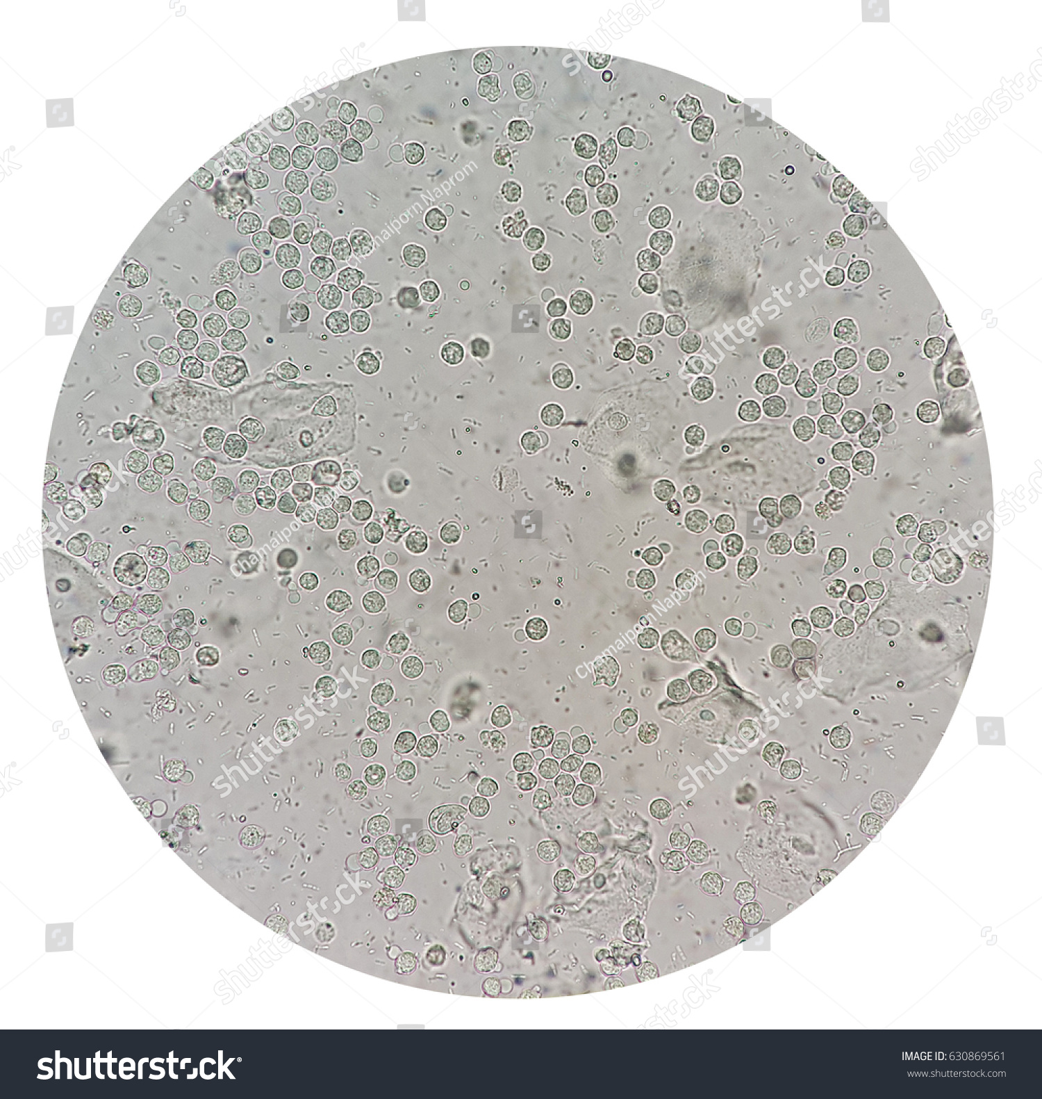 White Blood Cells Bacteria Urine Under Stock Photo Shutterstock