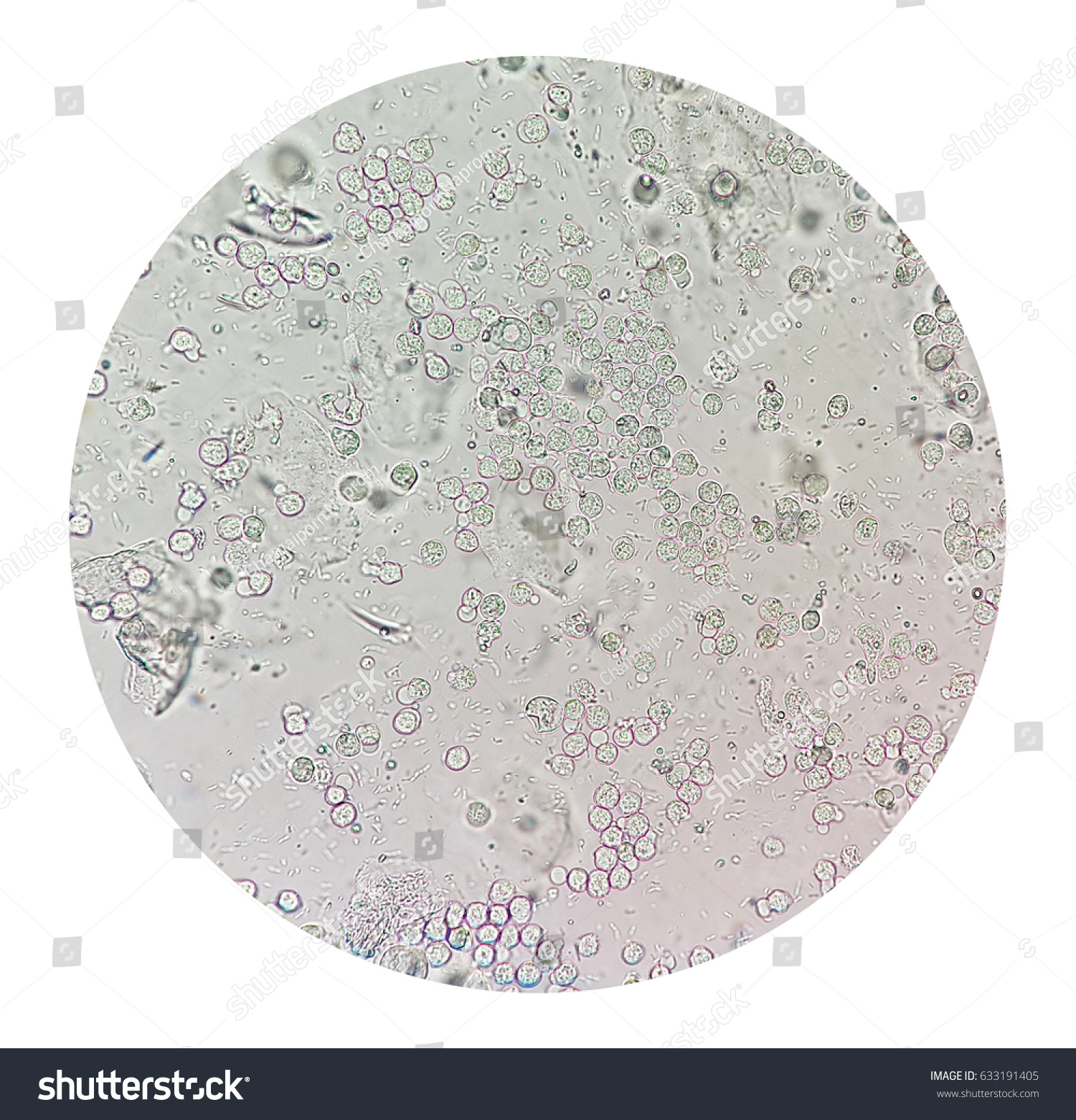 Wbc In Urine With Bacteria 7773