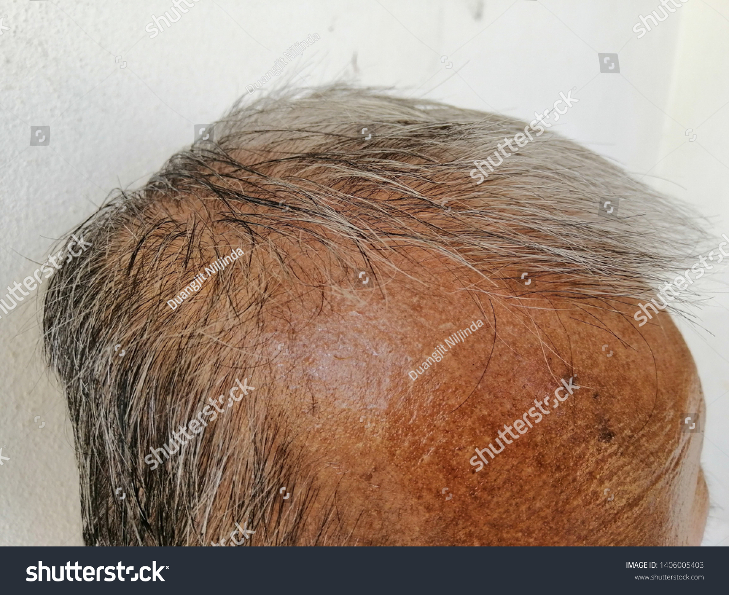 White Hair Thin Hair Bald Head Stock Image Download Now