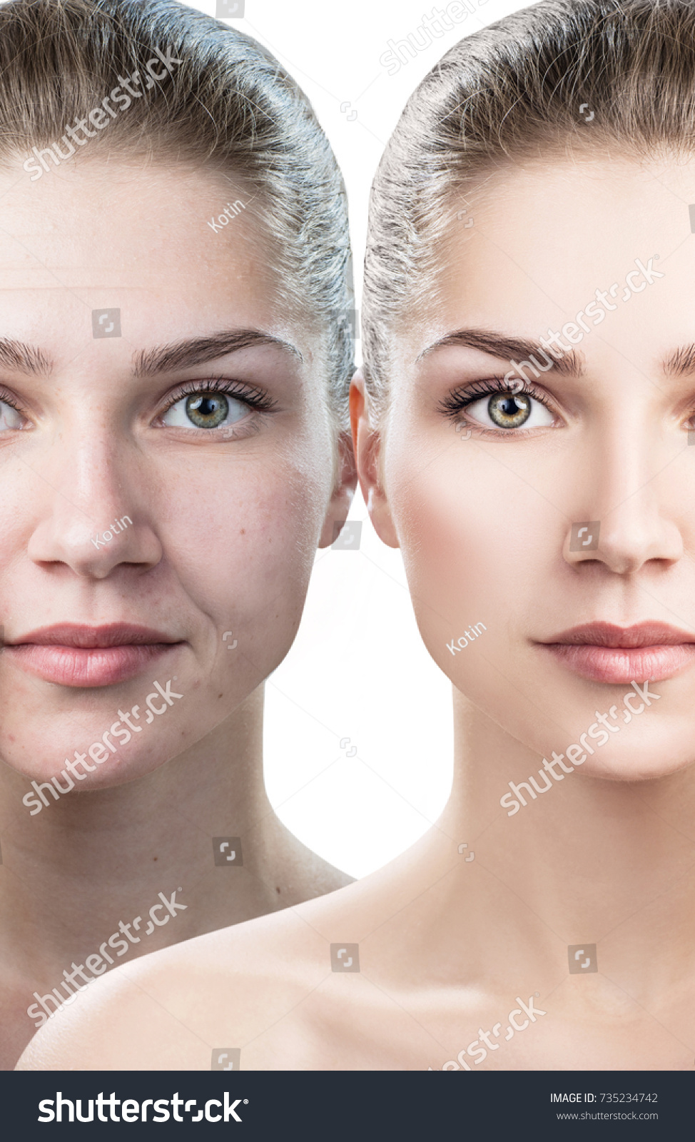 Womans Face Before After Rejuvenation Stock Photo Shutterstock