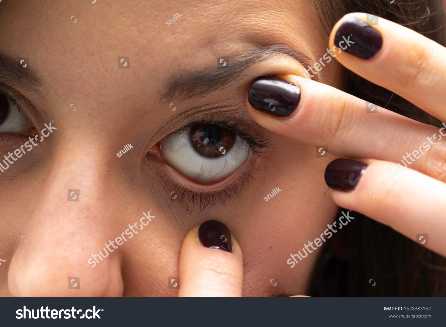 Woman Showing Eye Capillaries Red Arteries Foto De Stock 1528383152