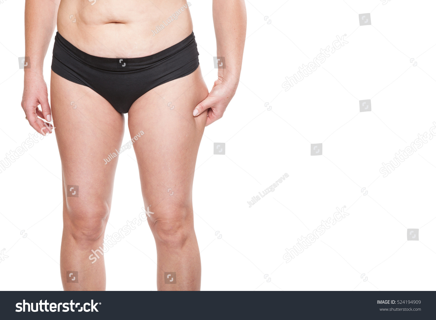 Anti-cellulite diet - a lifeline in the river cellulite Anti-cellulite diet - a lifeline in the river cellulite