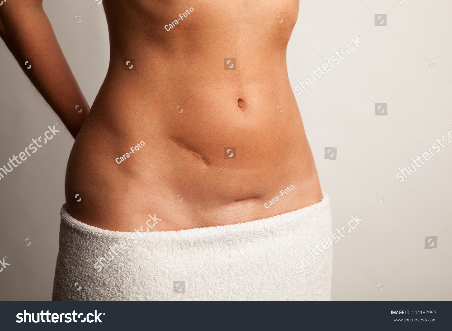 Where logic? pictures of naked girls with scars on belly Have pictures of naked girls with scars on belly apologise