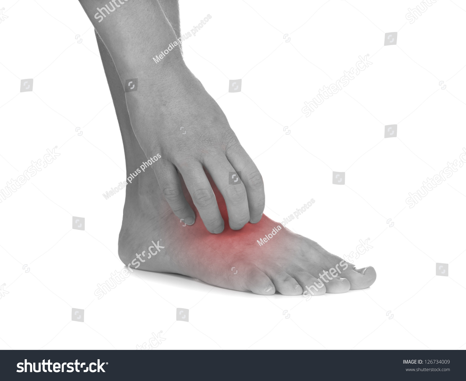 Women Scratch Itchy Leg With Hand. Healthcare And Medicine Concept ...