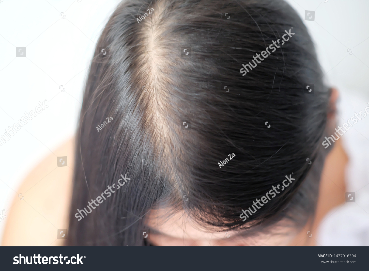 Women Thin Hair Caused By Hair Stock Photo Edit Now 1437016394