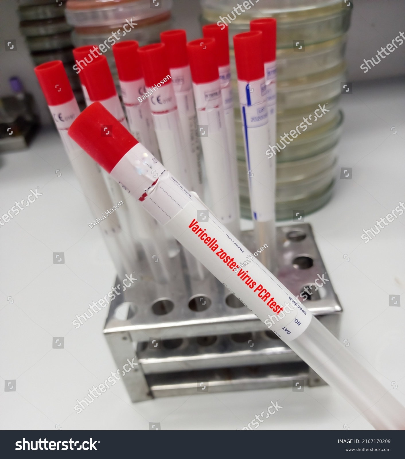 Wound Swab Varicellazoster Virus Pcr Test Stock Photo 2167170209