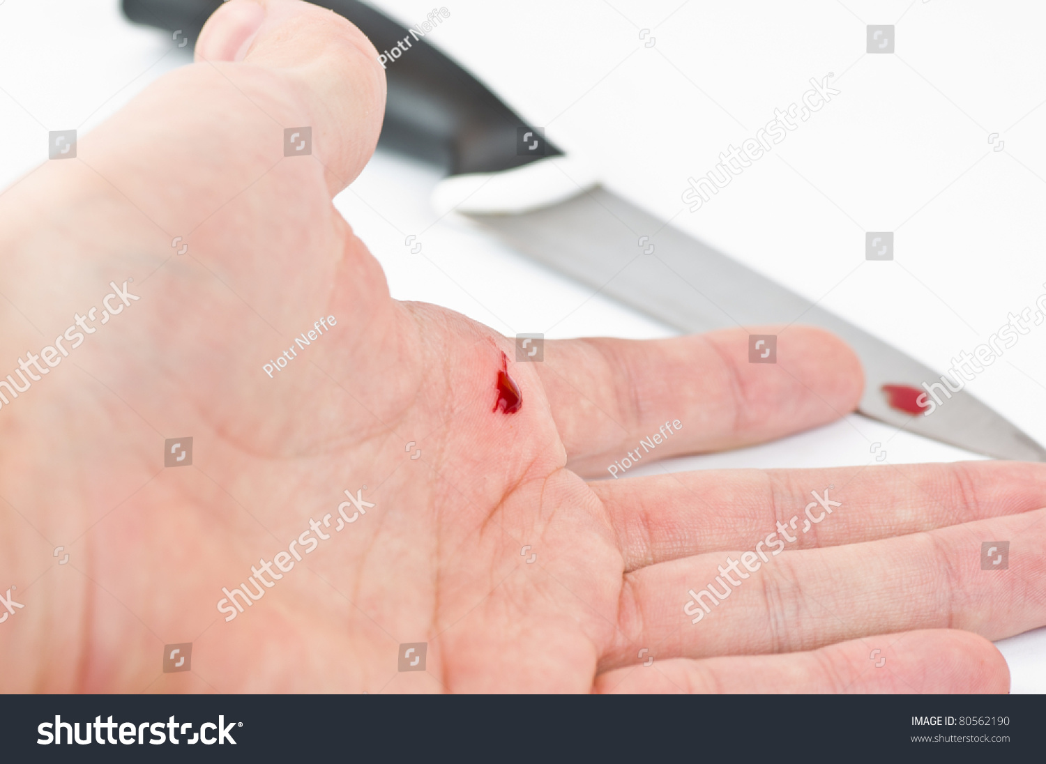 Wounded Hand And Knife Isolated On White Stock Photo 80562190 ...