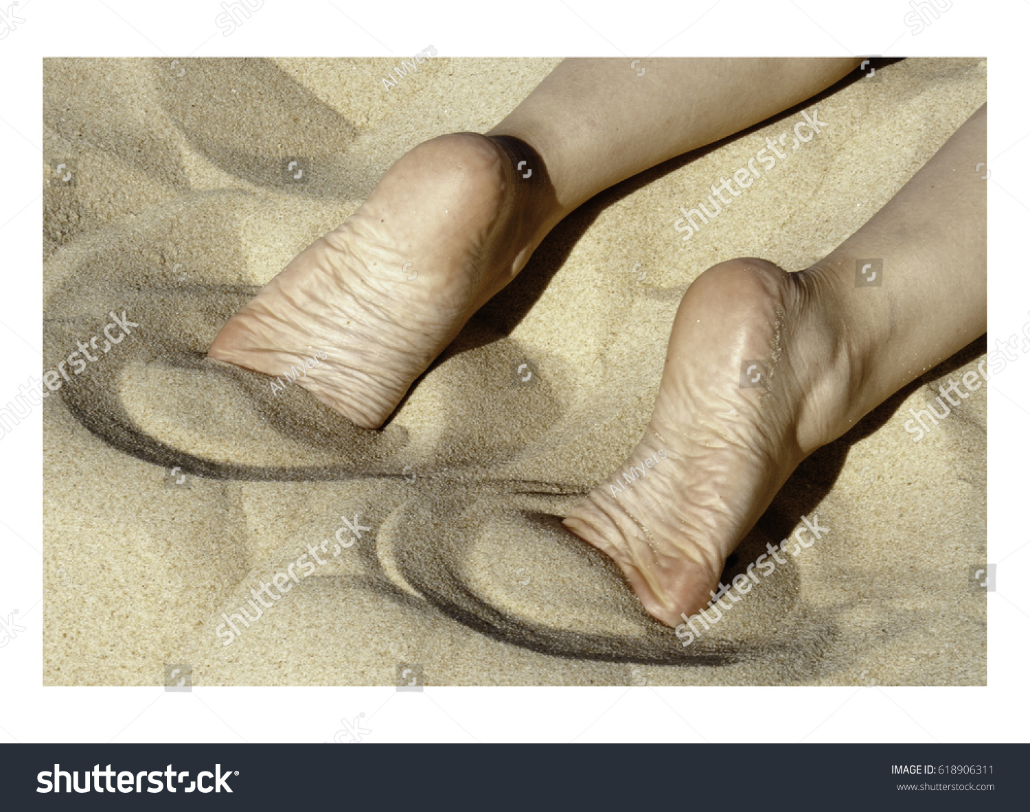 Wrinkled feet pics