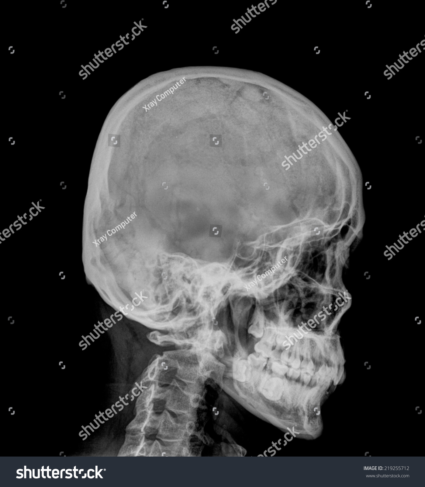 Xray Asian Skull Blank Area Right Stock Photo Edit Now 219255712