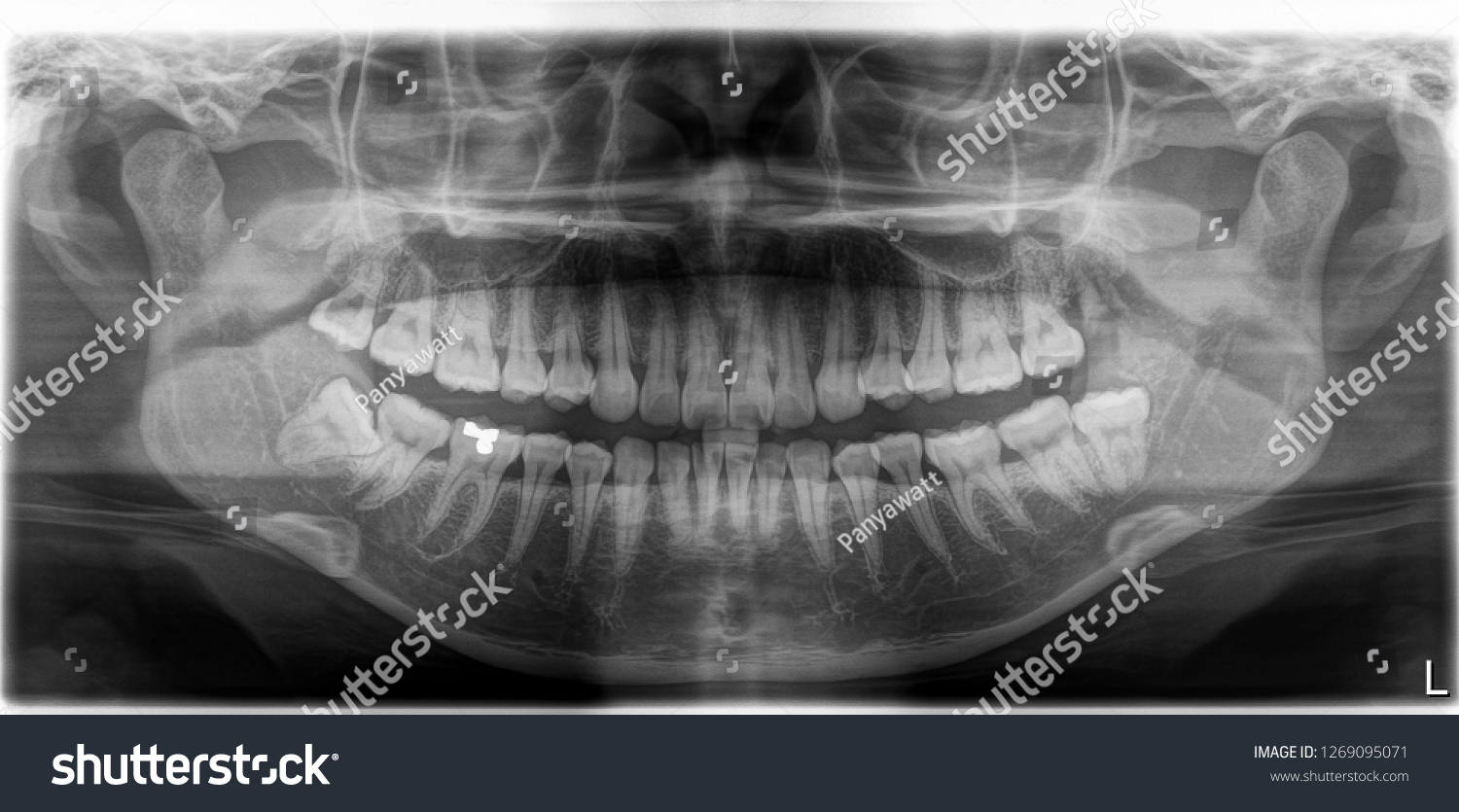 Xray Film Head Mouth Stock Photo 1269095071 | Shutterstock