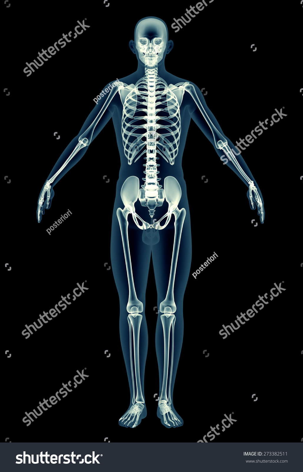 X Ray Full Human Body