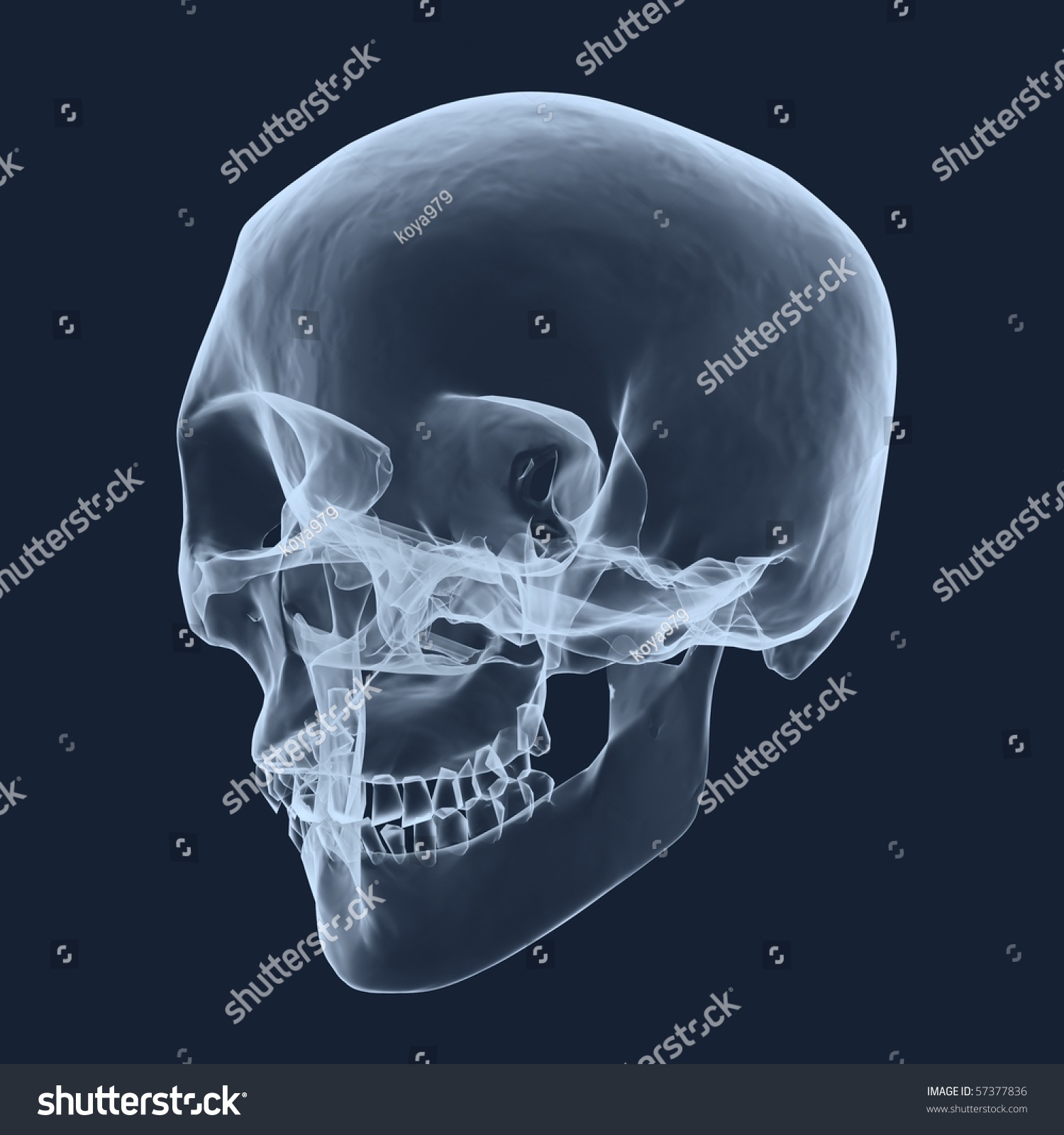 X-Ray Human Head Skull Stock Photo 57377836 : Shutterstock