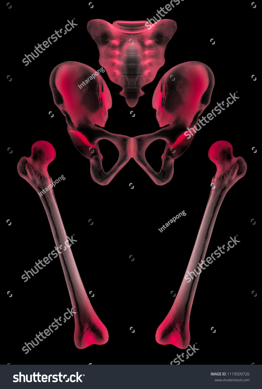 Xray Separate Human Hip Femur Bone 스톡 일러스트 1119509726 Shutterstock