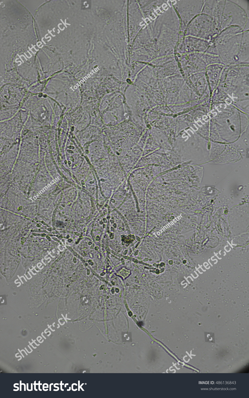 Yeast Cell Septate Pseudohyphae Cell Stock Photo 486136843 | Shutterstock