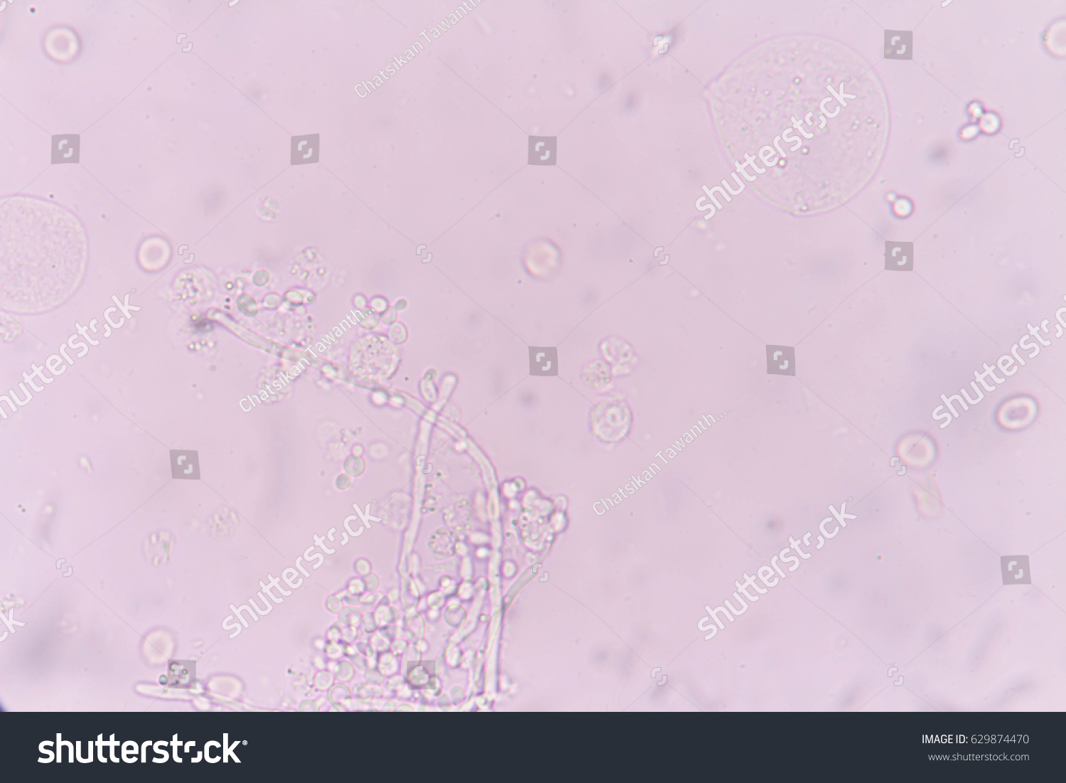 Yeast Cells Urine Red Blood Cells Stock Photo 629874470 | Shutterstock