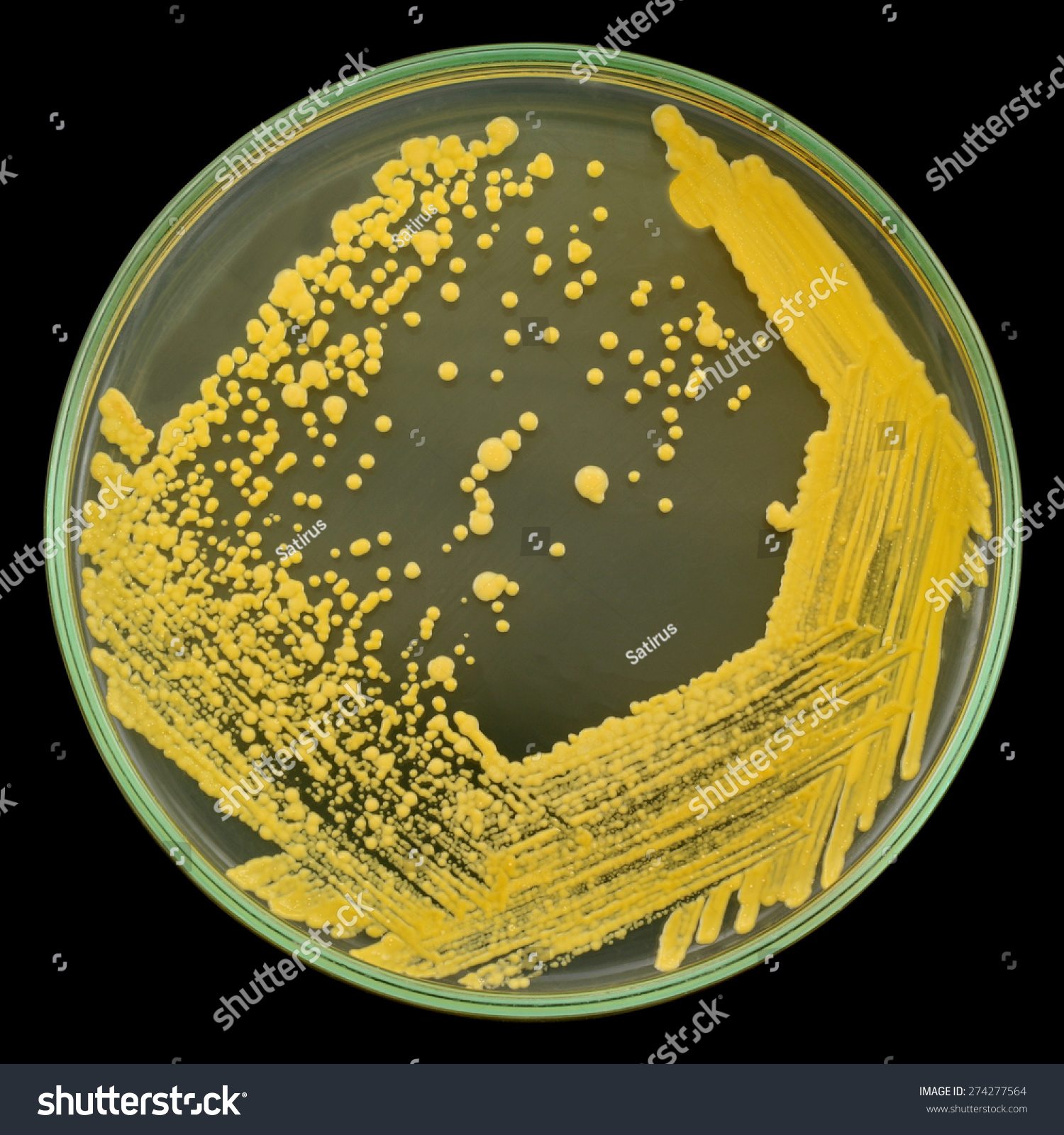 Yellow Bacterial Colonies Oildegrading Culture On Stock Photo (Edit Now ...