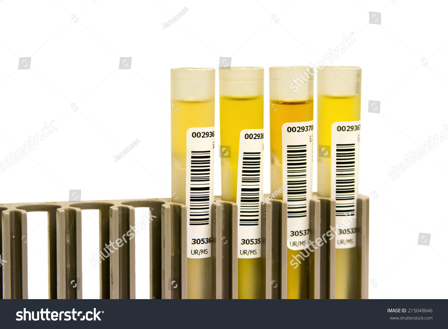 Yellow Urine Medical Analysis For Automate Stock Photo 215049646   Stock Photo Yellow Urine Medical Analysis For Automate 215049646 