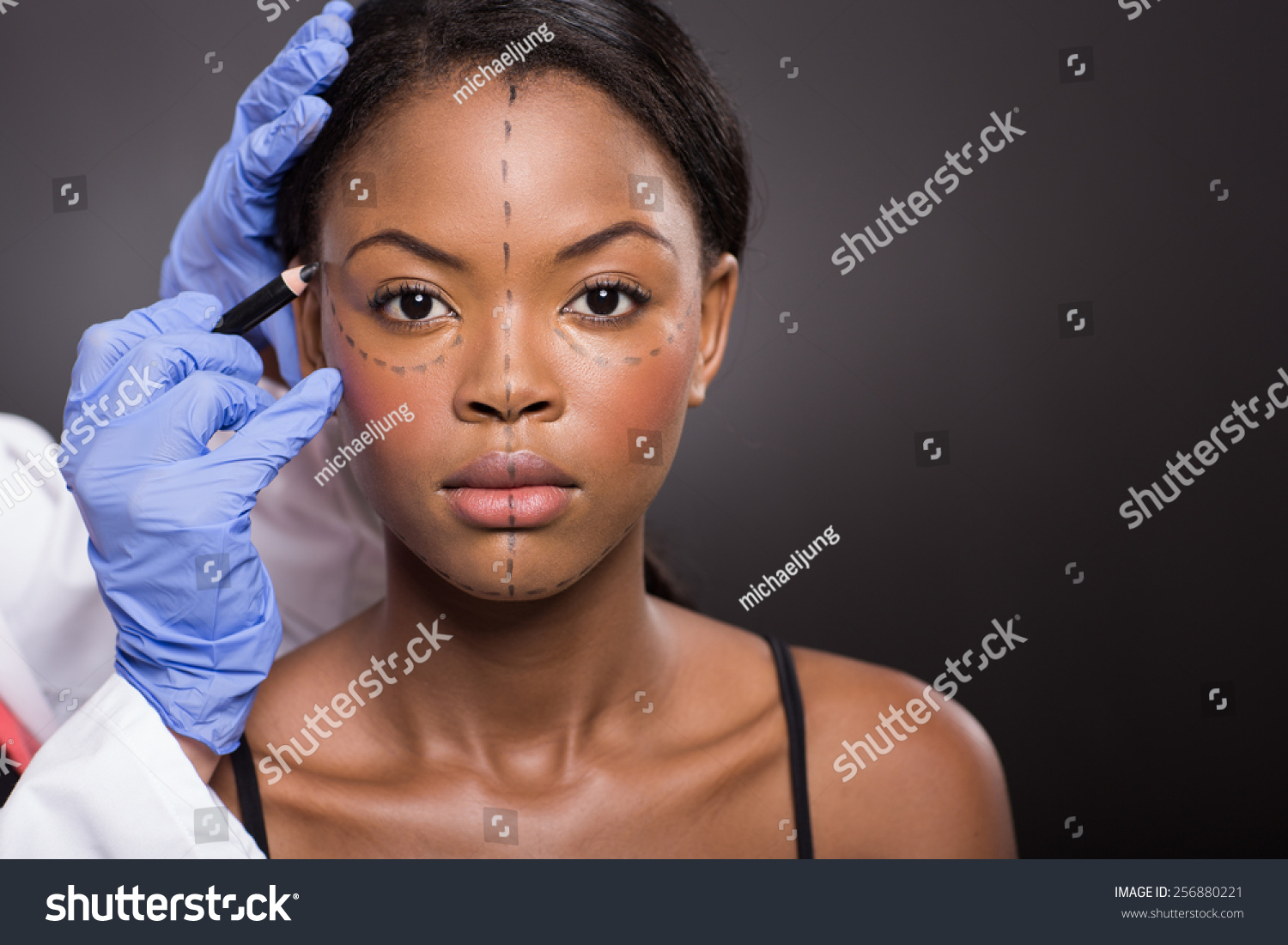 11 666 Black Women For Plastic Surgery Images Stock Photos Vectors   Stock Photo Young African Woman With Correction Mark For Plastic Surgery 256880221 