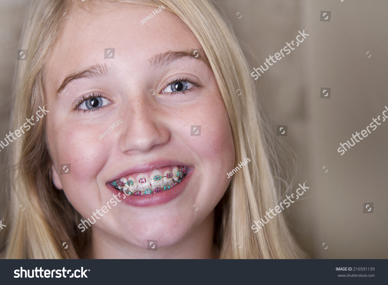 Cute Girl Braces For Teeth