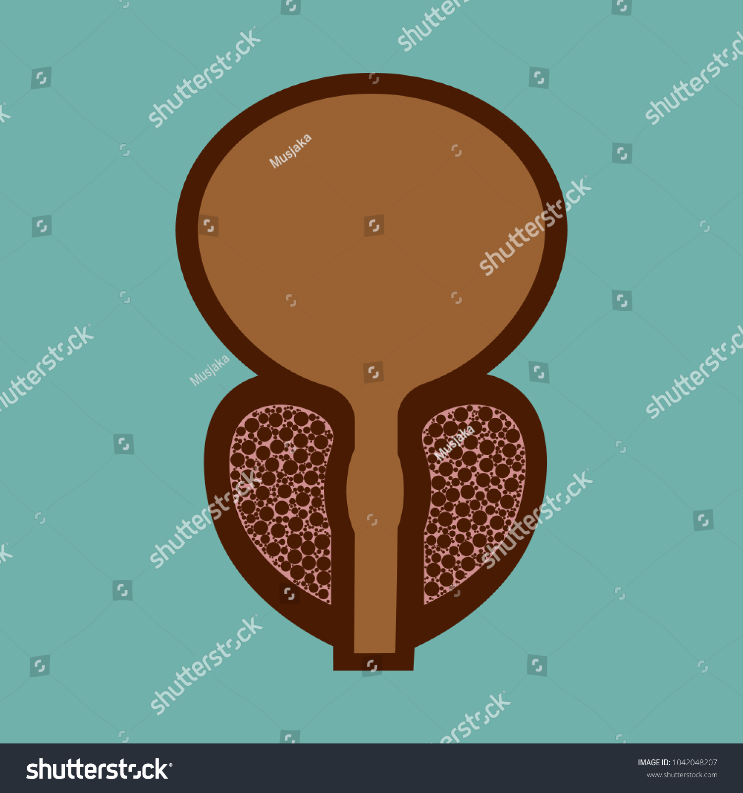 Vector Illustration Prostatitis Sexual Infections Prostate Stock Vector 3348