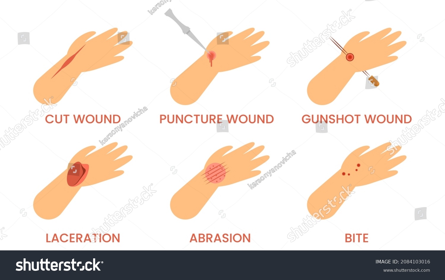 4-334-laceration-stock-vectors-images-vector-art-shutterstock