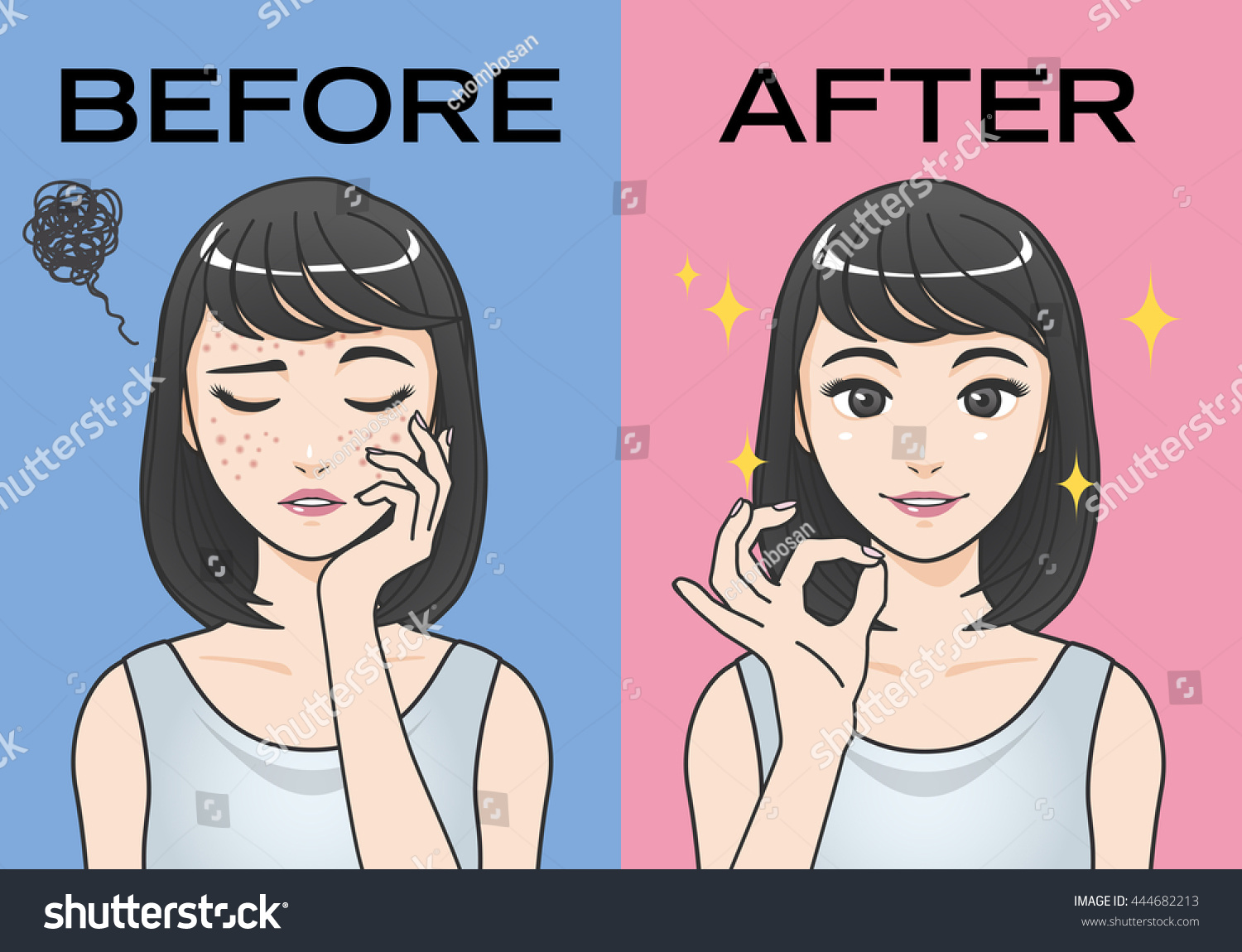 SVG of acne treatment before after cartoon illustration svg