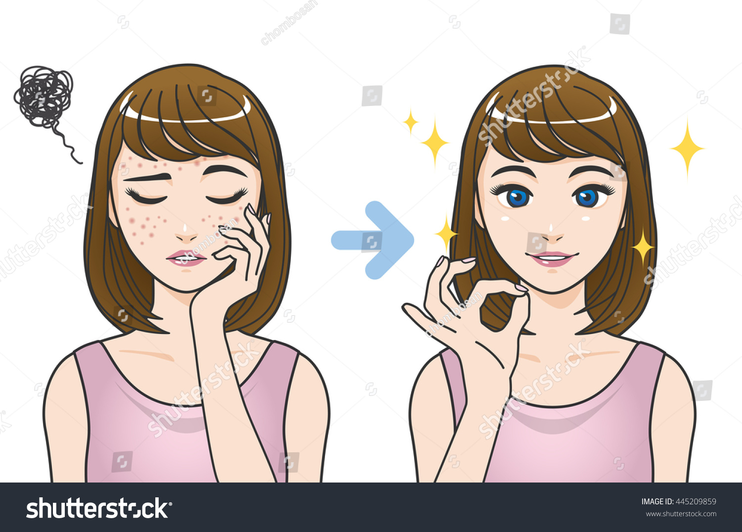 SVG of acne treatment before after cartoon illustration svg