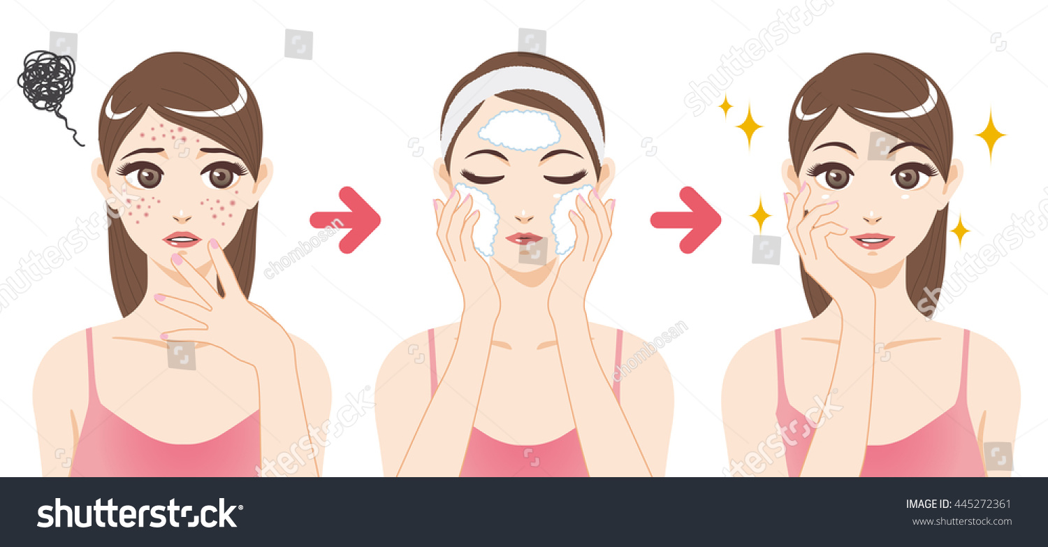 SVG of acne treatment before after, facial cleansing foam, cartoon illustration svg