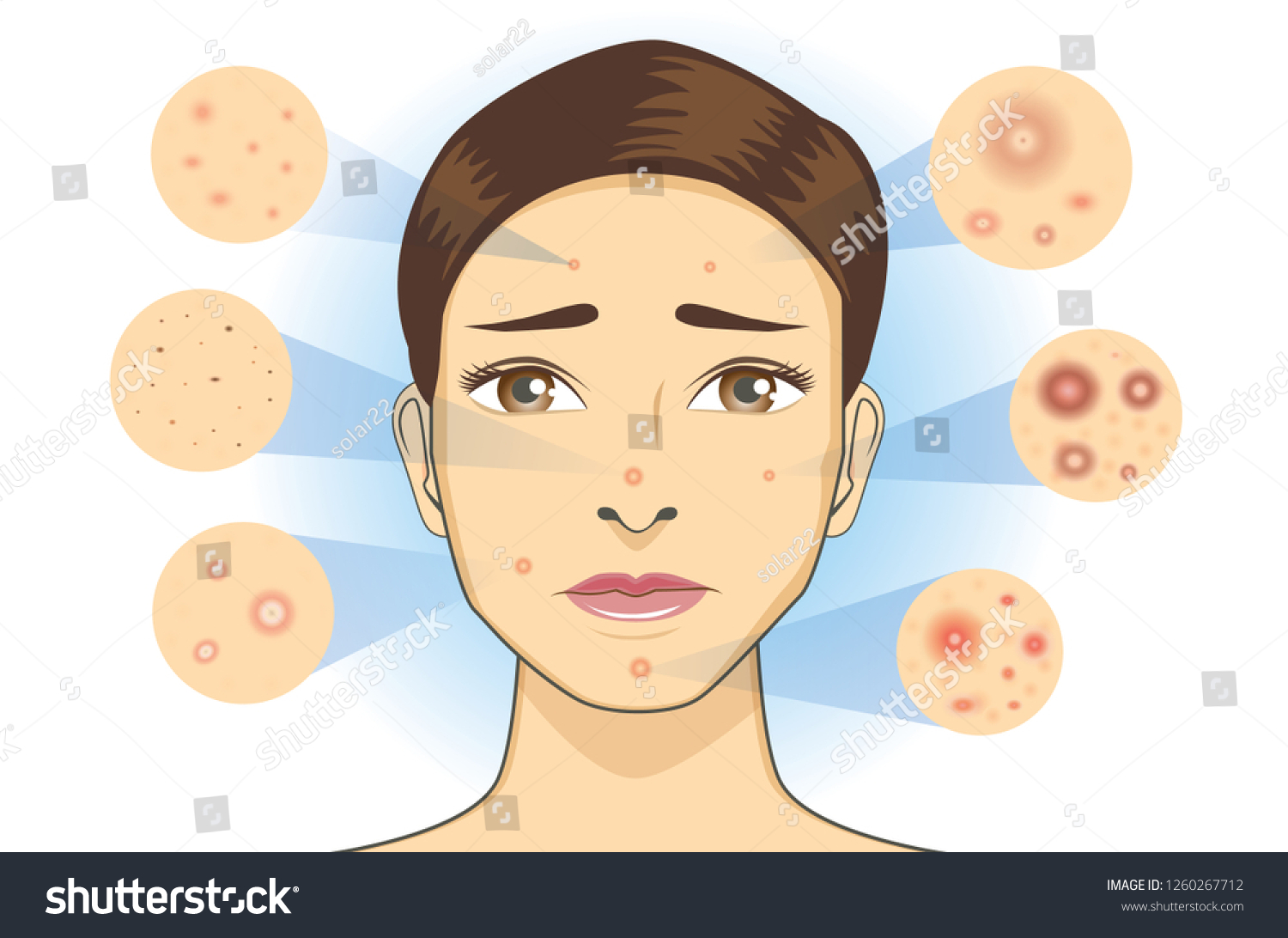 All Type Acne Icon Facial Skin Stock Vector (Royalty Free) 1260267712