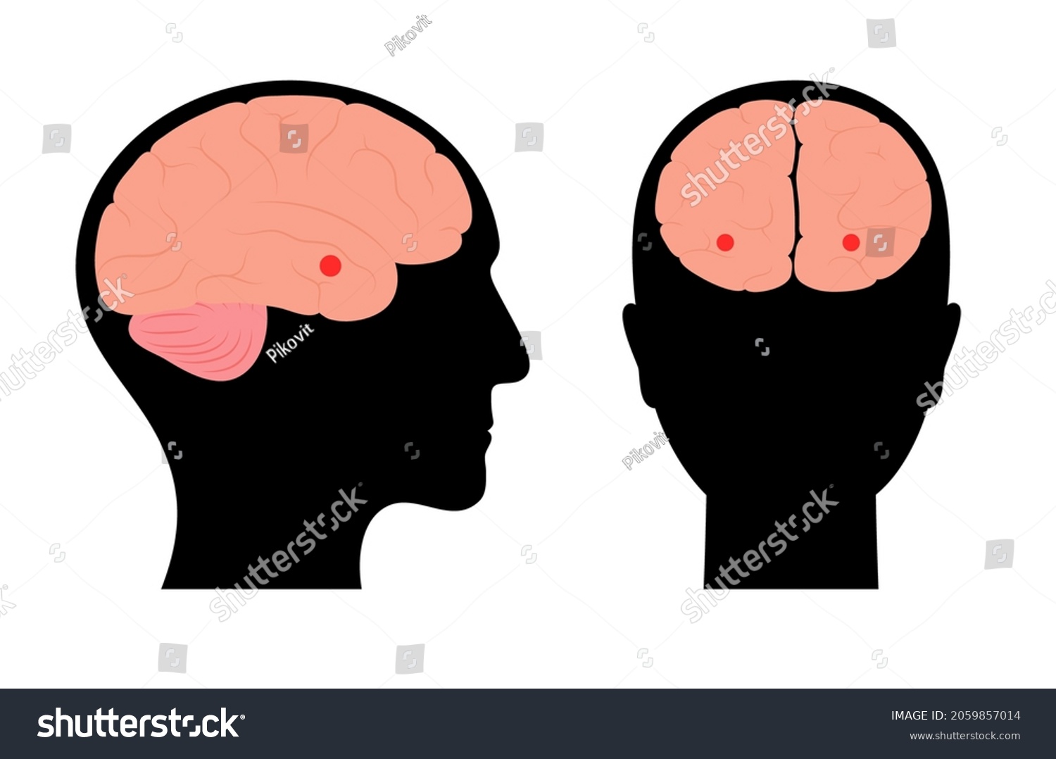 SVG of Amygdala and limbic system concept. Human brain anatomy in male silhouette. Cerebral cortex and cerebrum medical poster flat vector illustration for clinic or education. svg