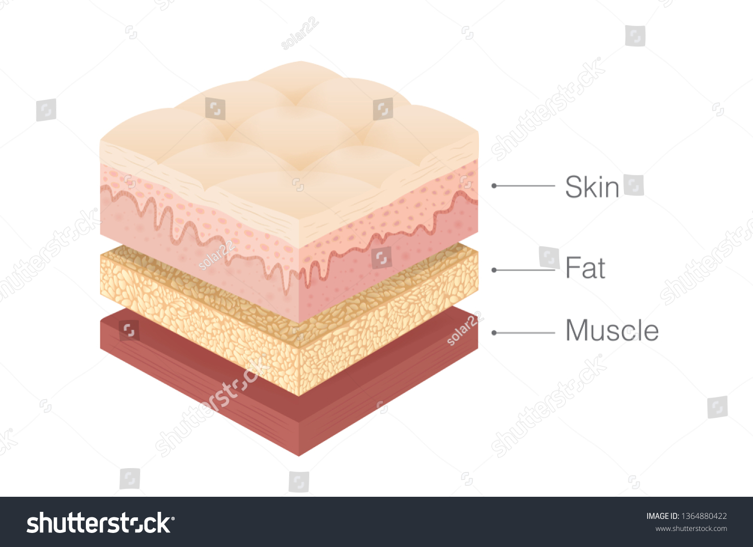 人間の皮膚層 等角投影法の脂肪層 筋肉層の構造 医療と健康に関するイラスト のベクター画像素材 ロイヤリティフリー