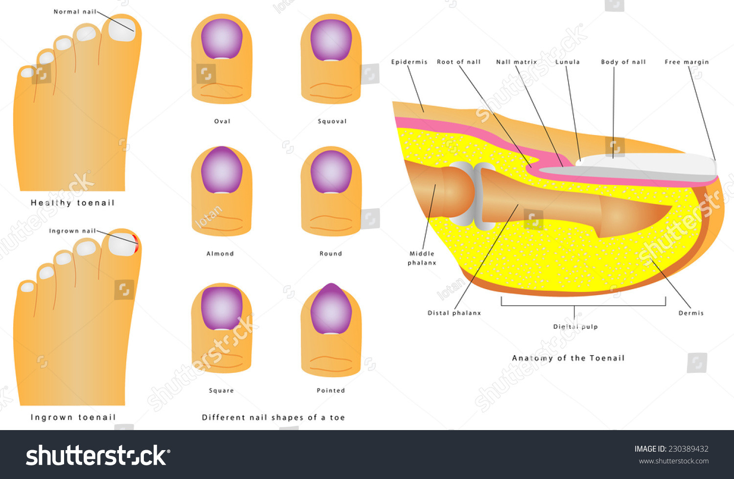 Anatomy Toenail Different Shapes Toenail Healthy Stockvector