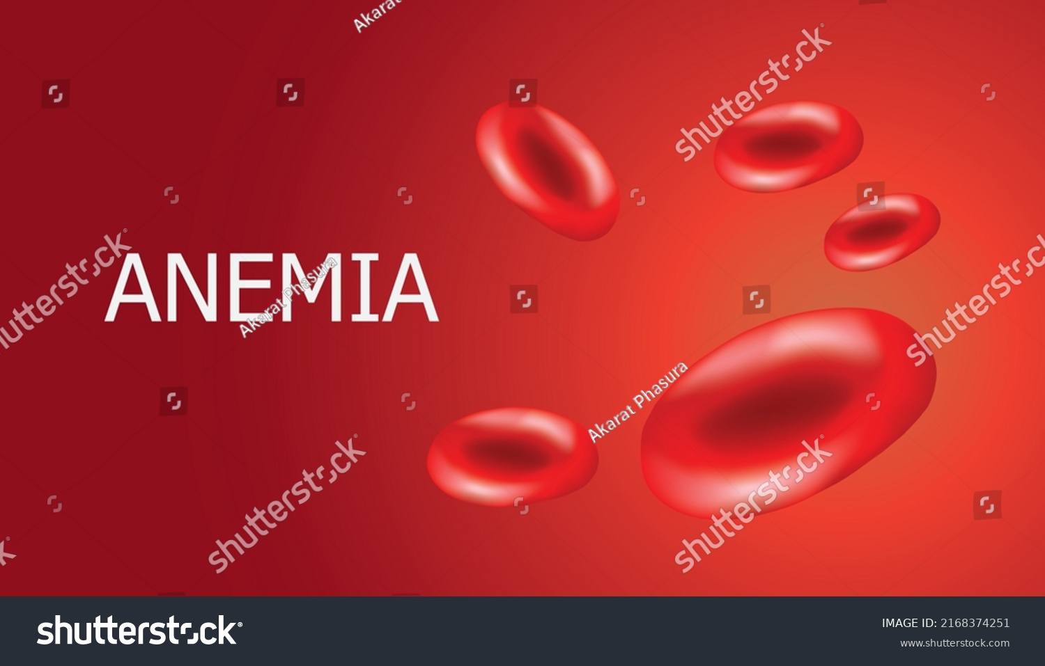 Anemia Realistic Vector Red Blood Cells Stock Vector (Royalty Free ...