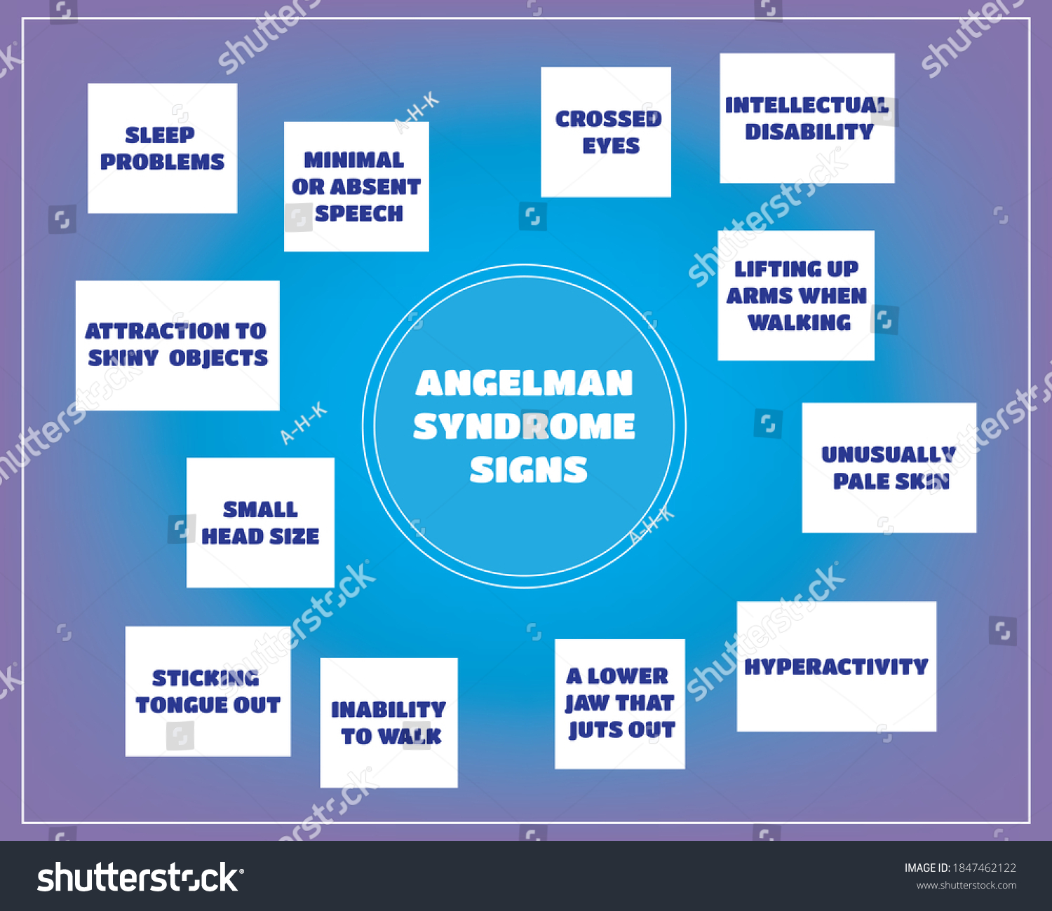 SVG of Angelman syndrome signs.Vector illustration for medical journal or brochure.  svg