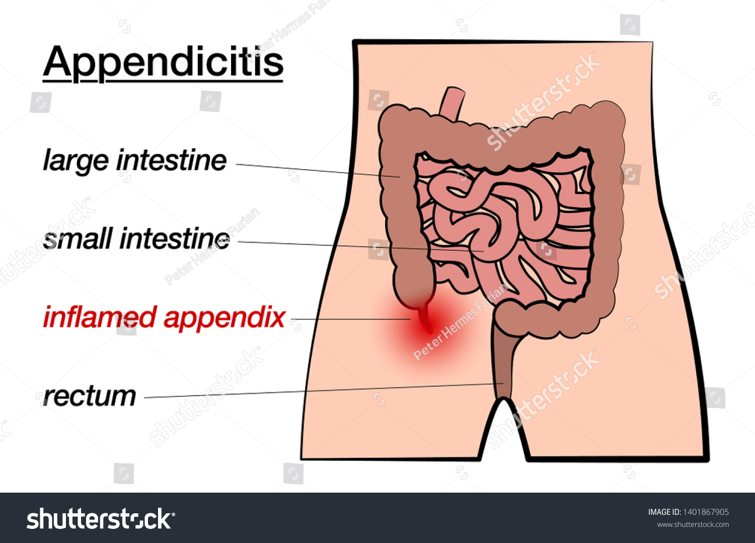 Appendix Appendix in