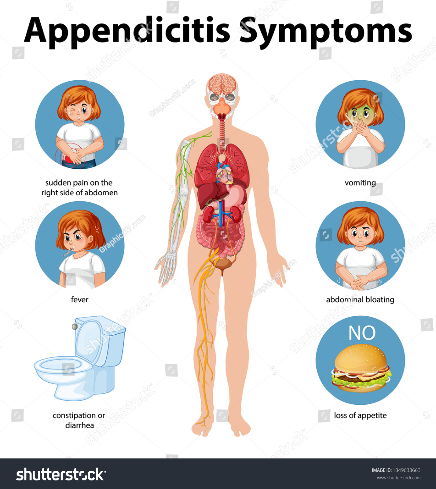 Appendicitis Symptoms Information Infographic Illustration   Stock Vector Appendicitis Symptoms Information Infographic Illustration 1849633663 