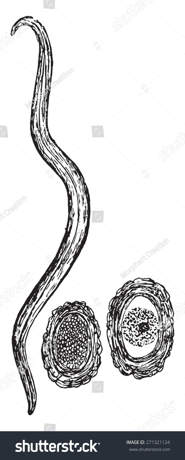 Ascaris Lumbricoides And Eggs Vintage Engraved Illustration