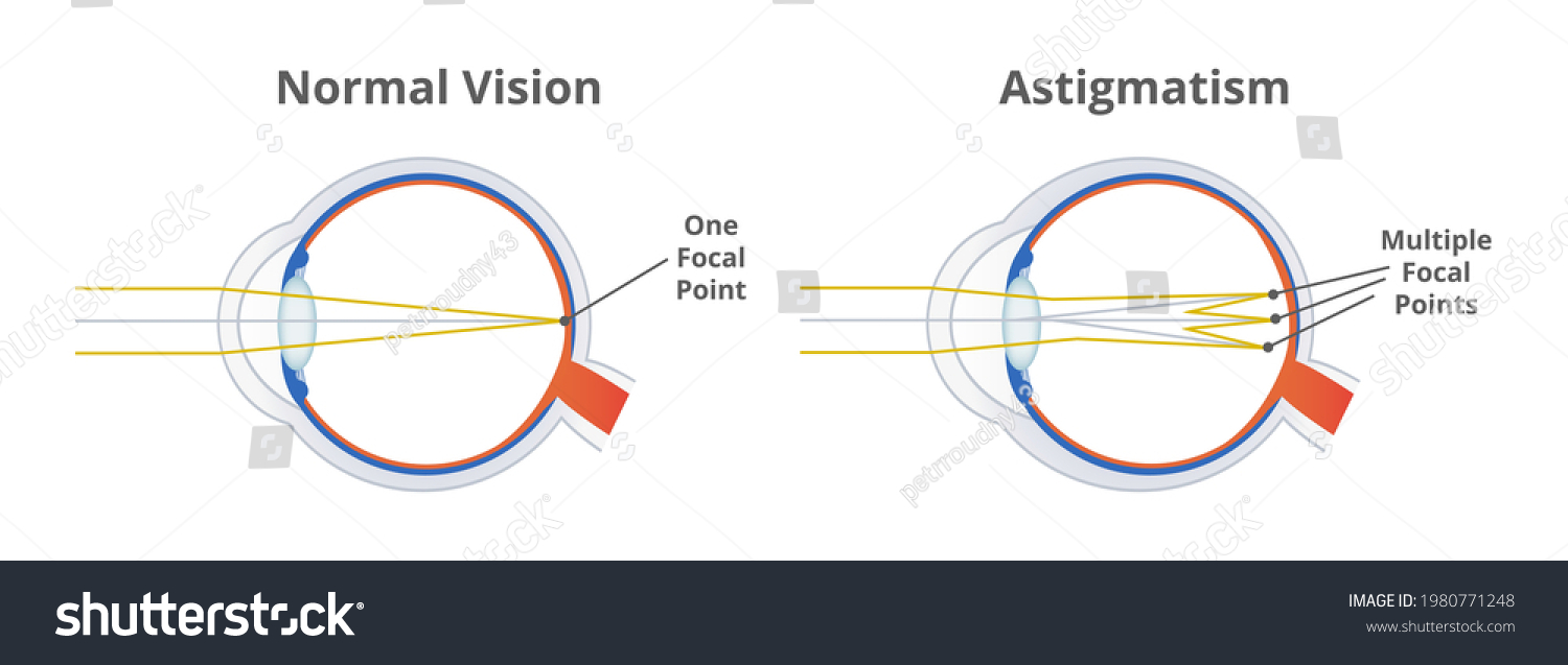 what focuses light on the back of the eyeball