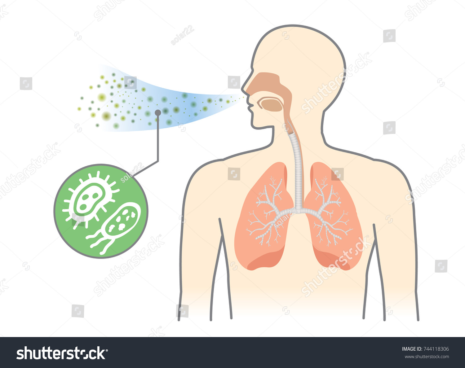 細菌や菌類が呼吸から人の呼吸に入る 大気汚染に関するイラスト のベクター画像素材 ロイヤリティフリー