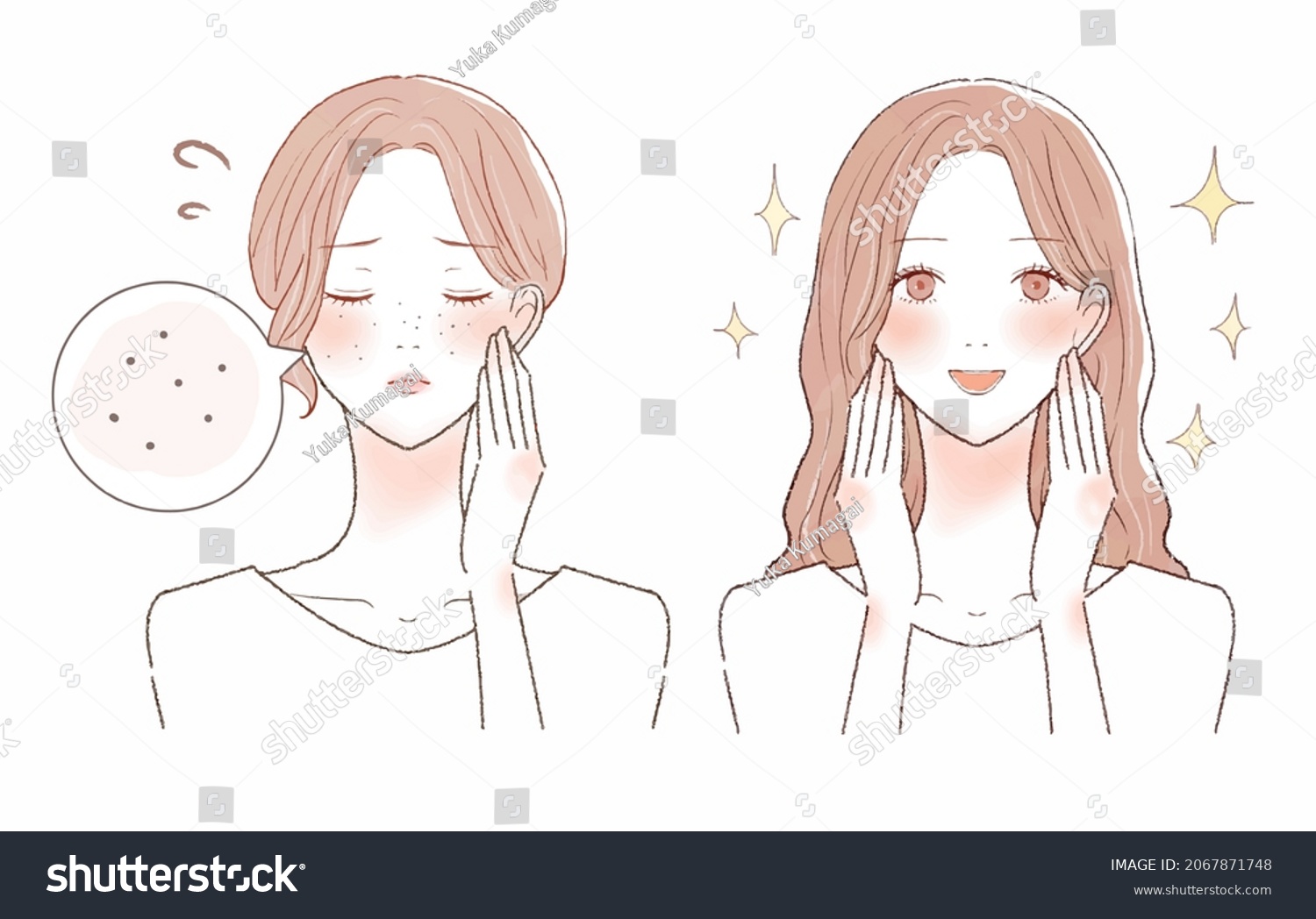 SVG of Before and after of women suffering from darkening pores. On white background. svg