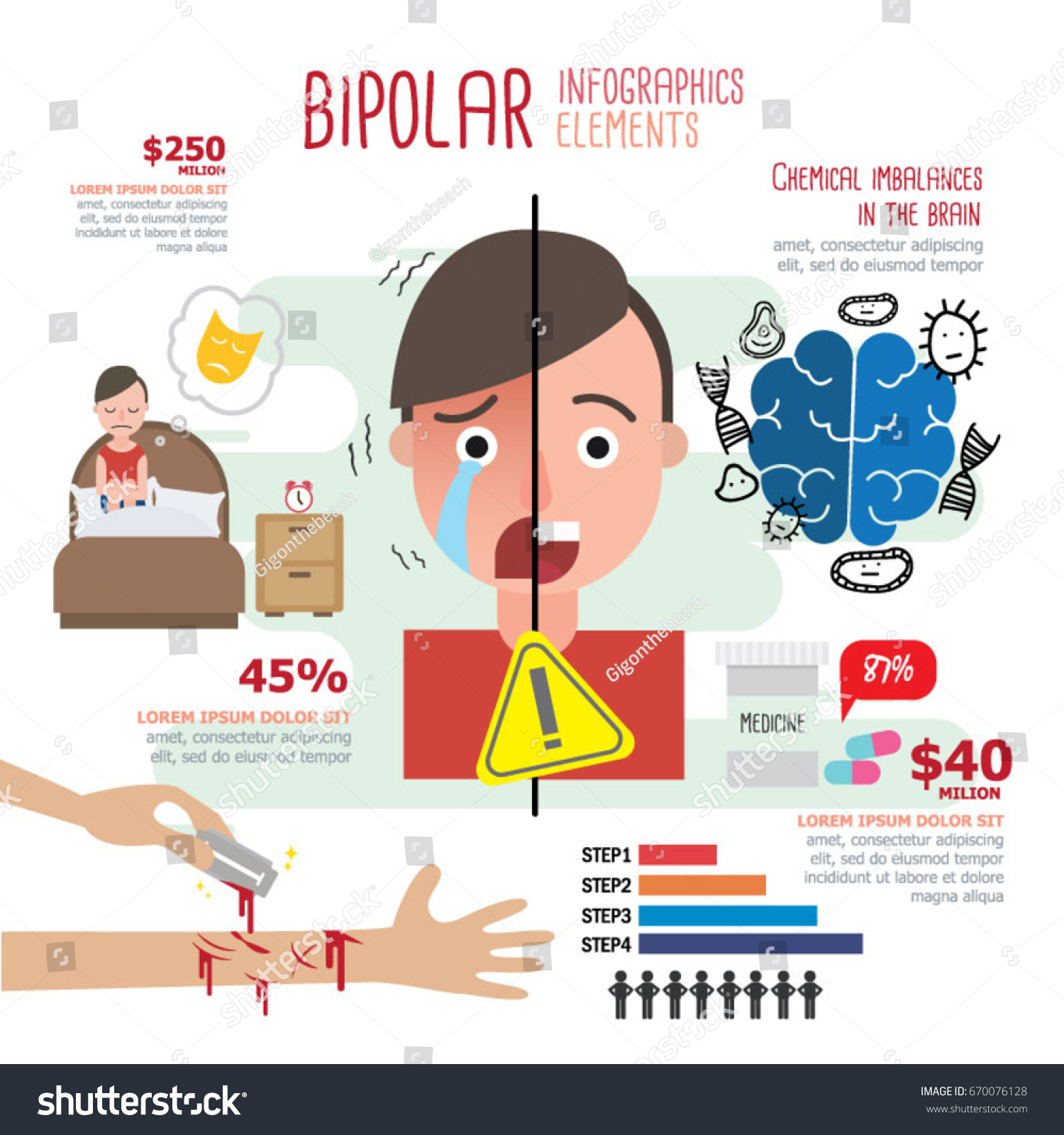 Bipolar Infographics: Vector De Stock (libre De Regalías) 670076128 ...