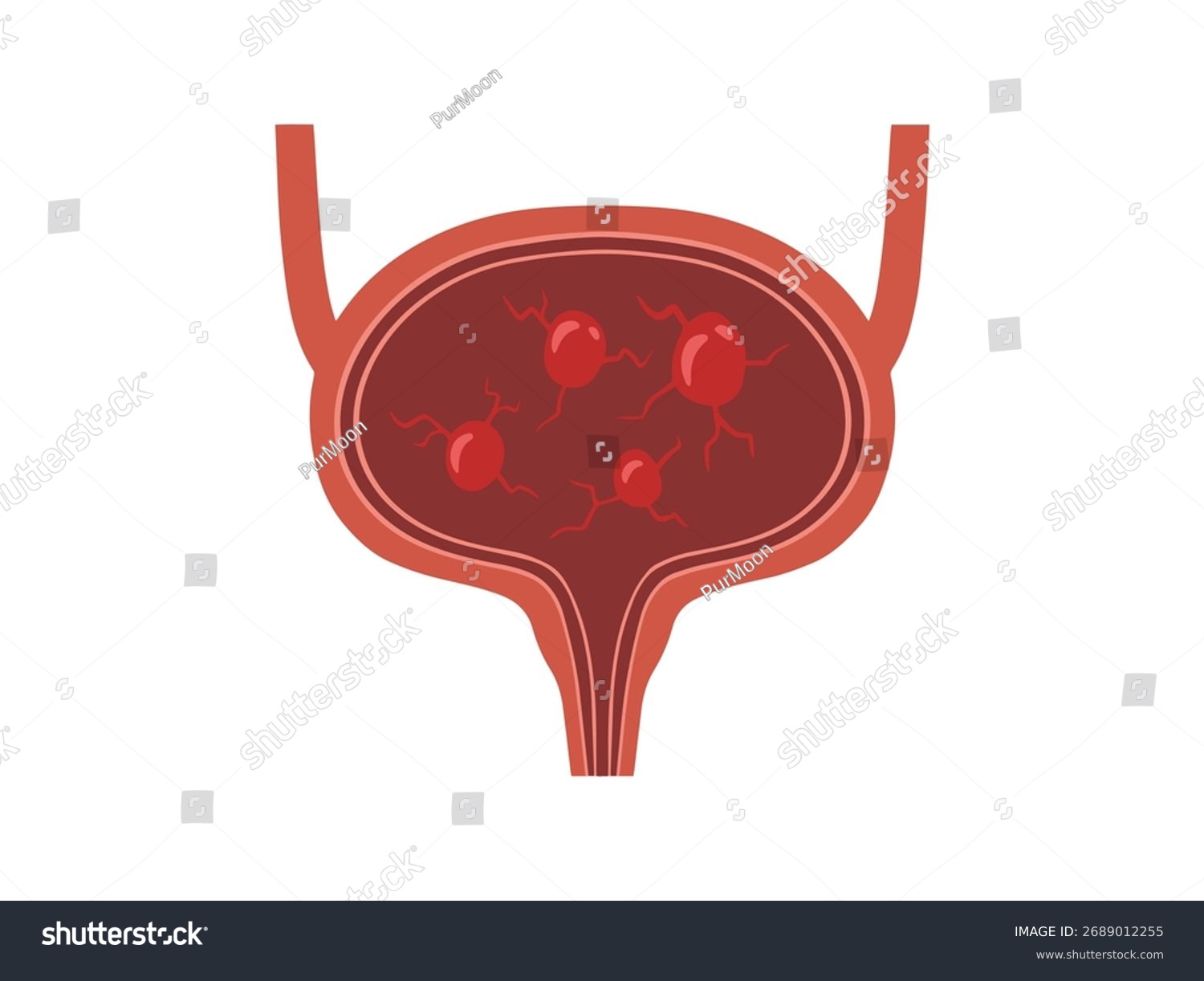 red bladder anatomy, medical diagram clip art preview