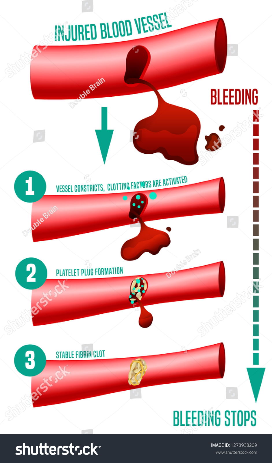 factor 12 in blood clotting name