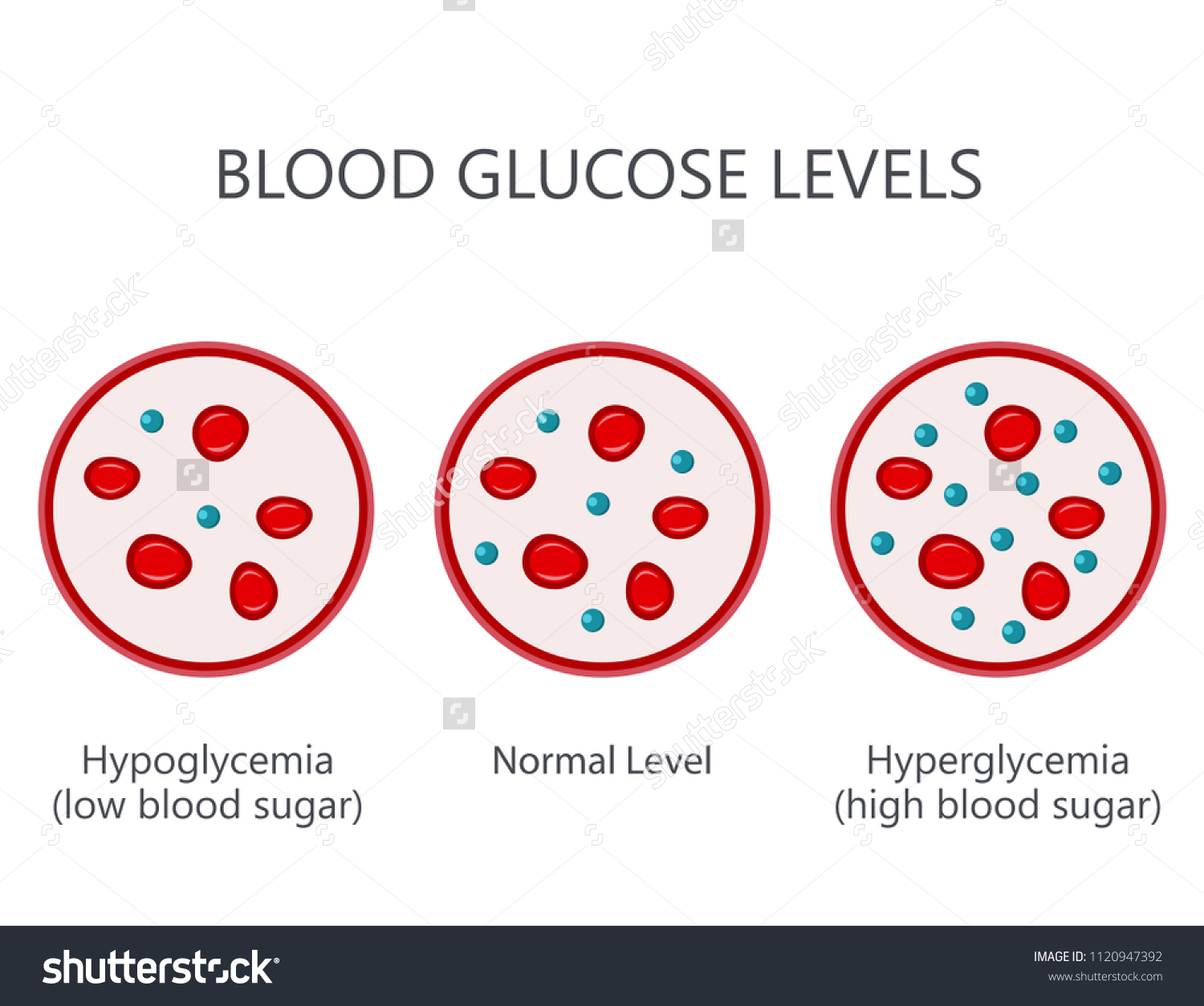 Blood Glucose Sugar Levels High Level Stock Vector (Royalty Free ...