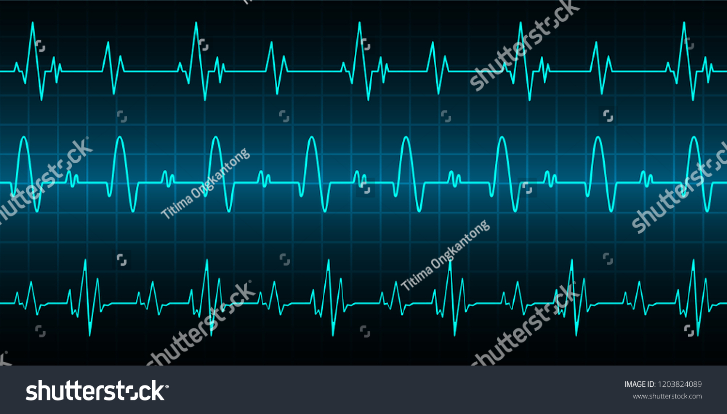 Blue Heart Pulse Monitor Signal Heart Stock Vector Royalty Free 1203824089 2800