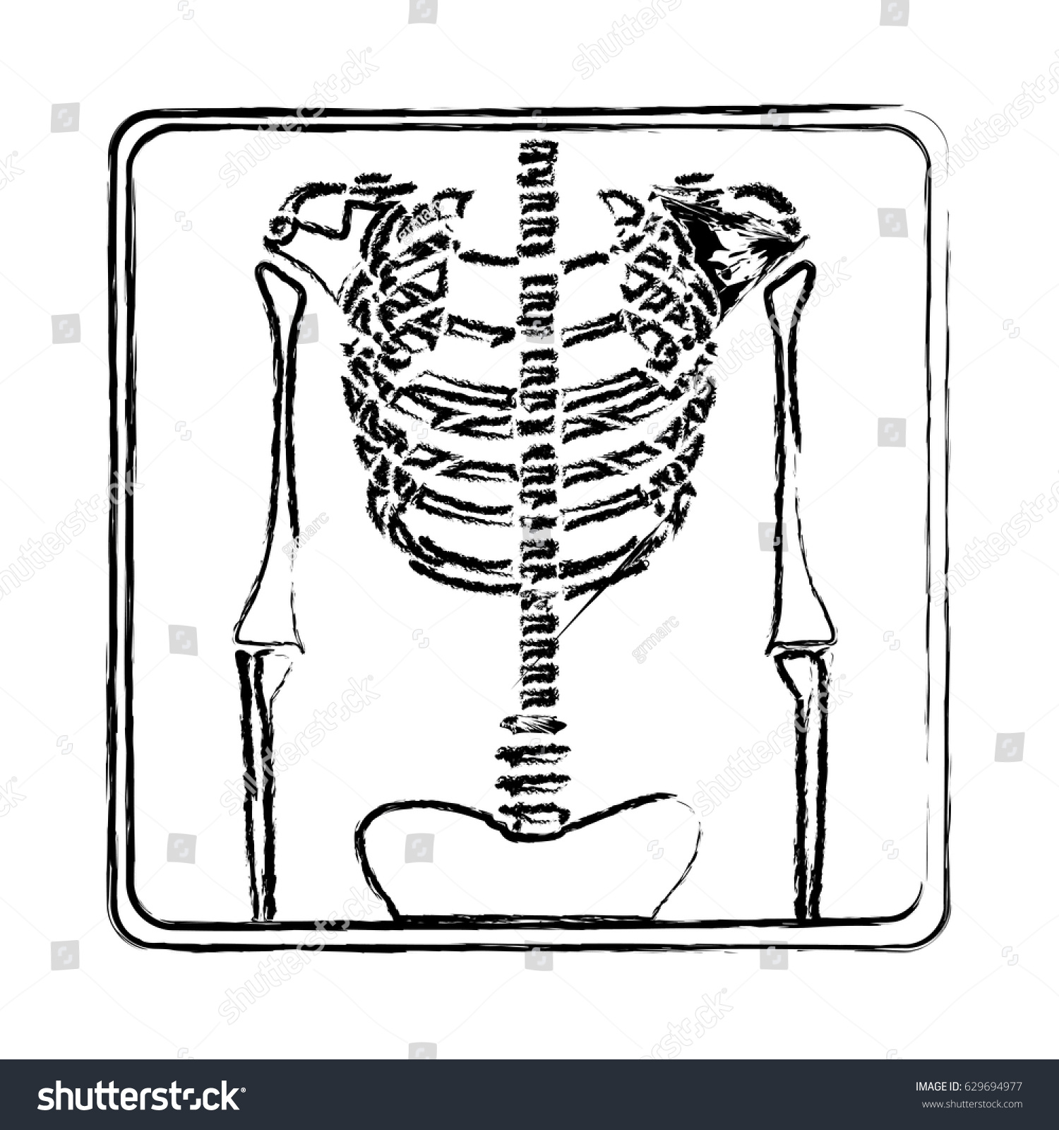 Blurred Silhouette Xray Bones Vector Illustration Stock Vector (Royalty ...